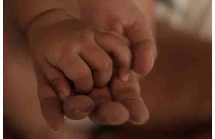 sindrome di Alstrom